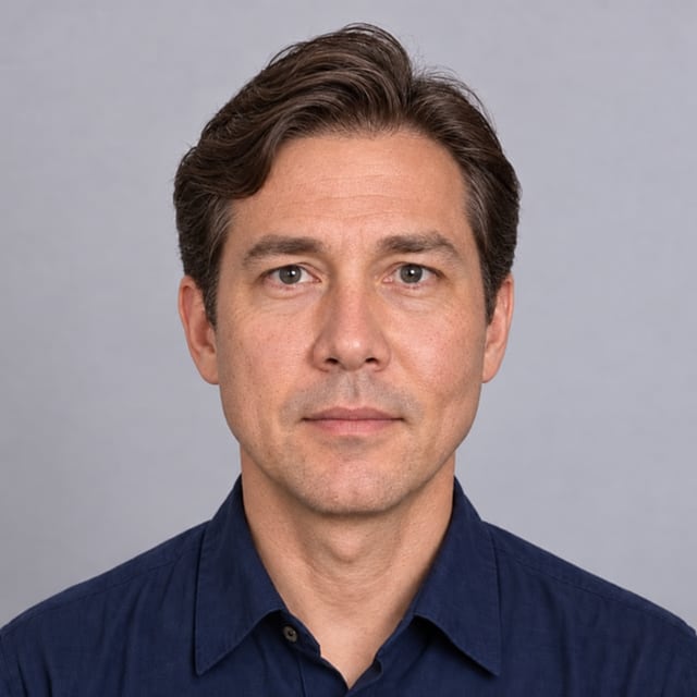 After Reducing cheekbone protrusion asymmetry