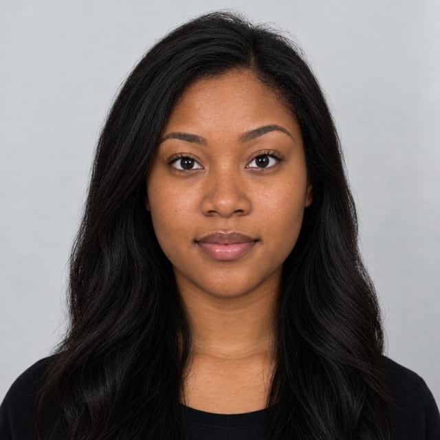 After Correcting forehead and eyebrow height asymmetry