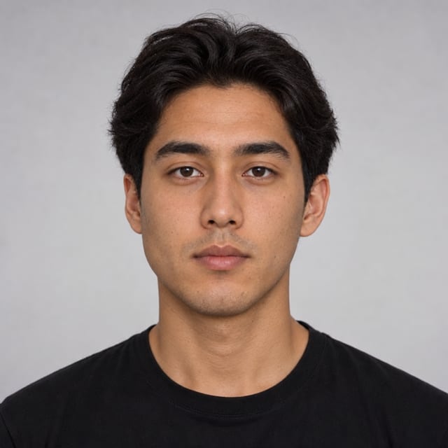 Avant Réduction de l'hypertrophie des muscles masticateurs gauches